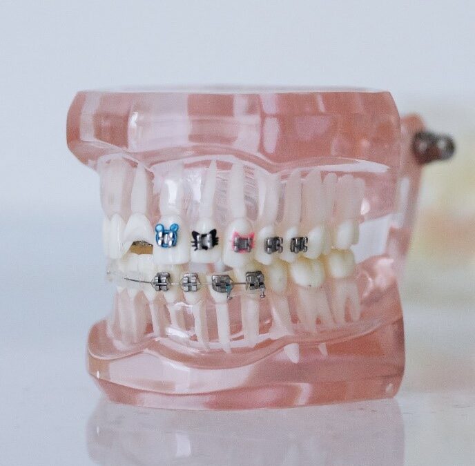 Braces for Adults: It’s Never Too Late!