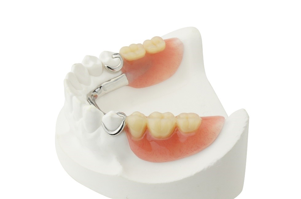 3 Benefits of Getting Partial Dentures