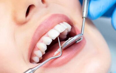 10 Things You Didn’t Know Your Dentist Was Doing at Your Checkup